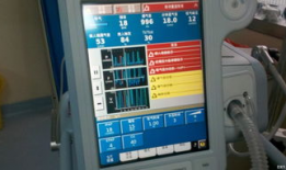 无创呼吸机使用视频